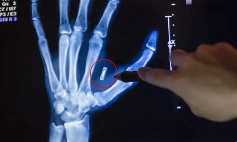 how to destroy an rfid chip|How would one damage or deactivate an implanted microchip .